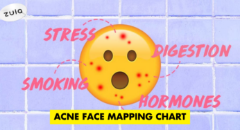 Acne Face Mapping Chart: What Your Breakouts Can Tell You About Your Health