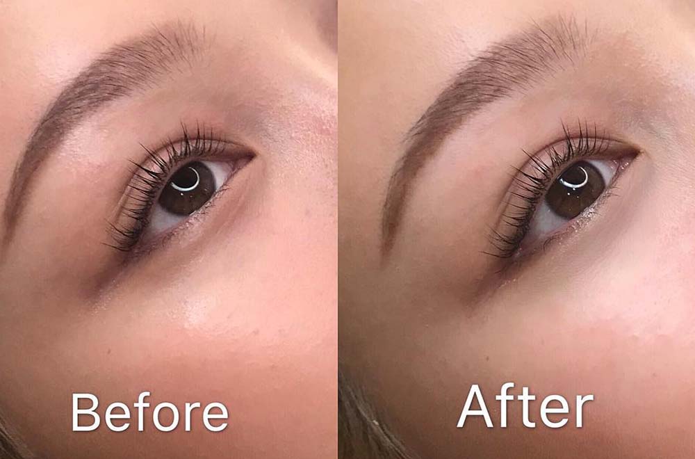 Permanent Under Eye Concealer Tattoo Is