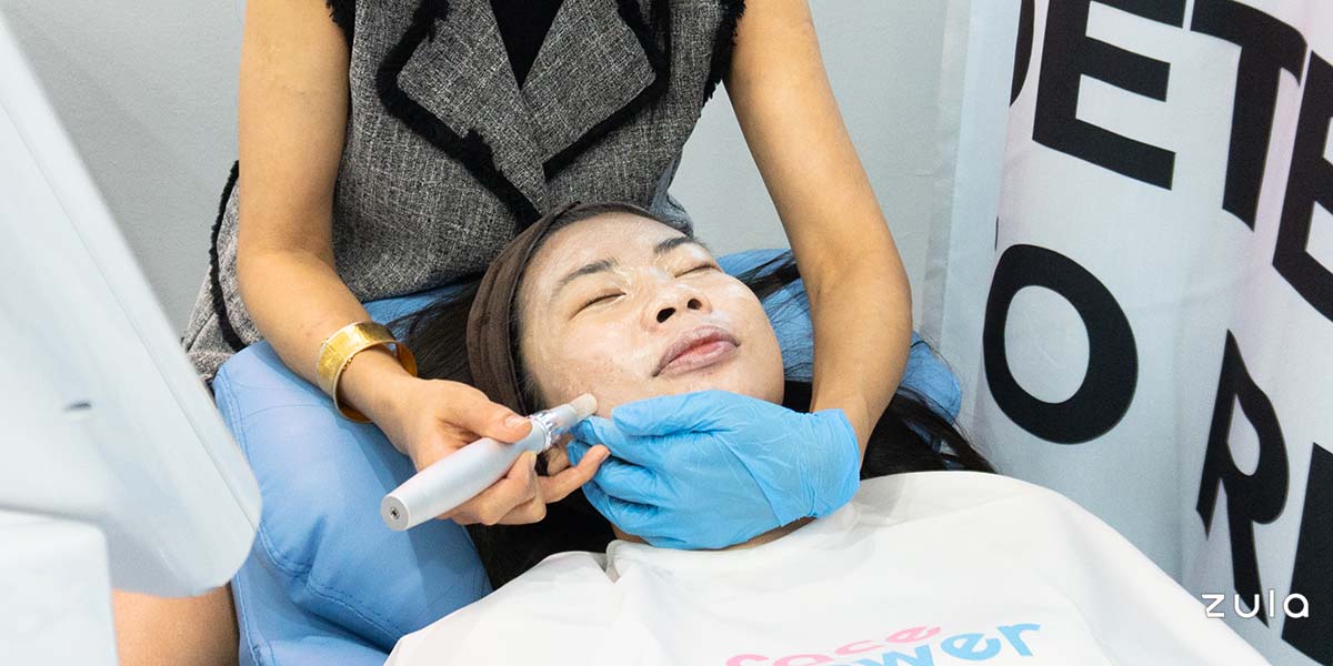 I Injected Skin-Coloured Pigment Into My Face To Get Clearer Skin: Semi-Permanent BB Cream Treatment Review