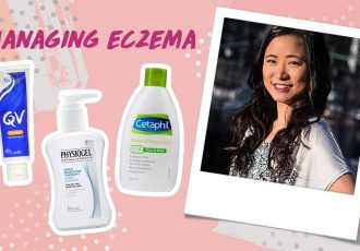 how to manage eczema