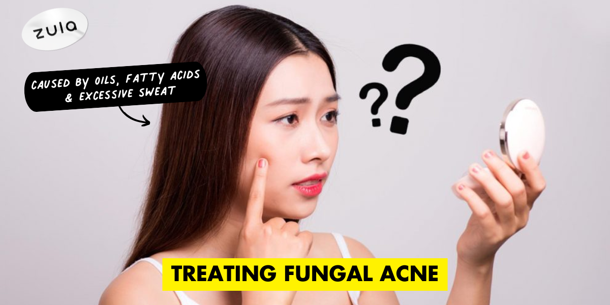 How To Identify Fungal Acne And Treatments 