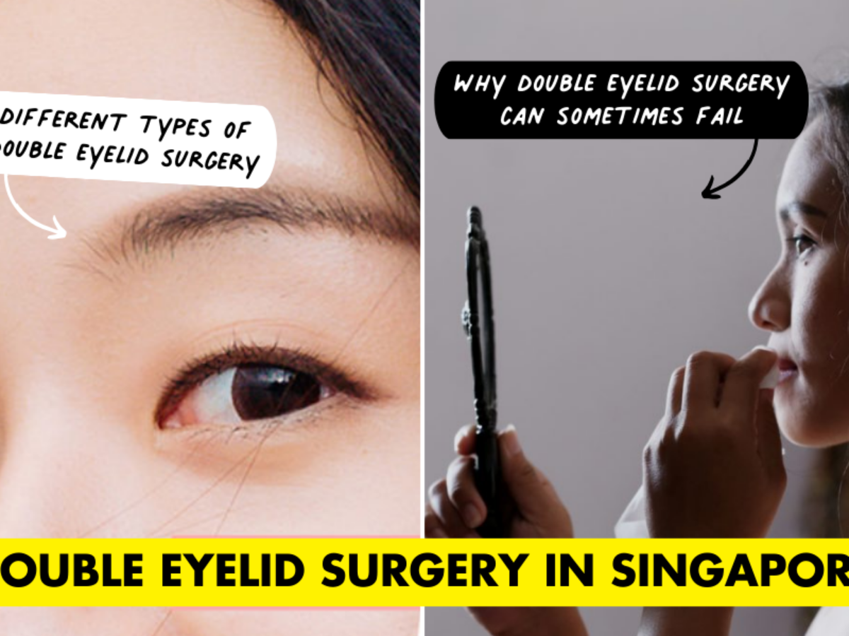 Double eyelid stitching sale price