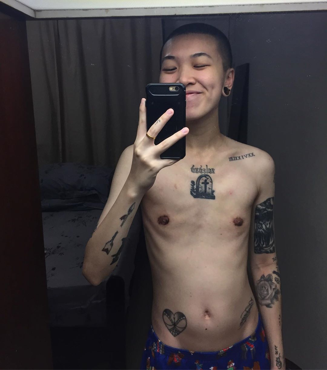 top surgery 3 weeks later