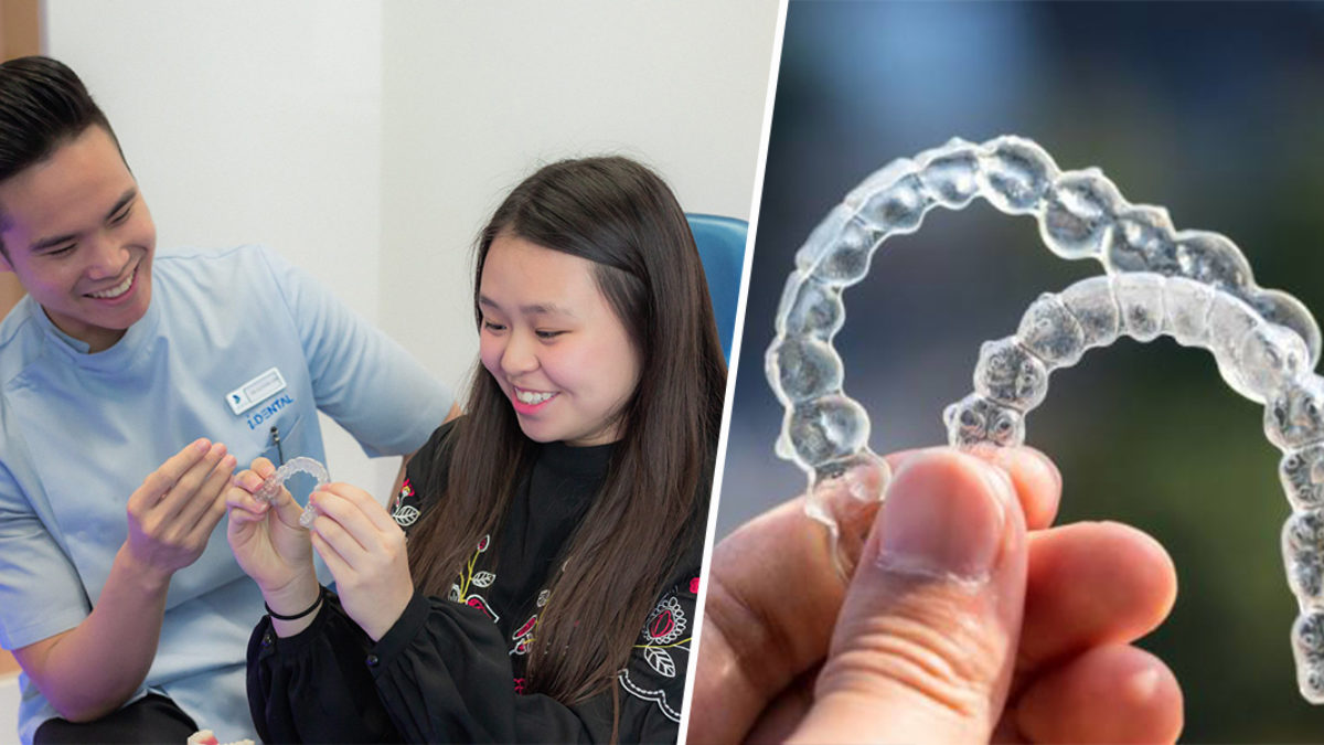 How much does it cost to get dental braces and Invisalign in Singapore?,  Money News - AsiaOne