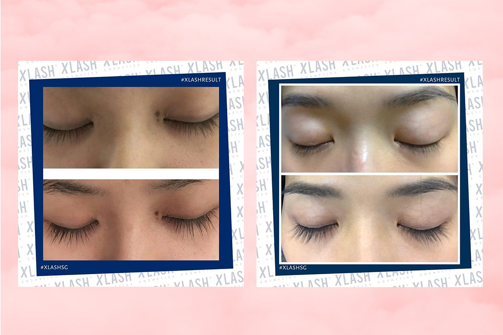 xlash-eyelash-serum-results