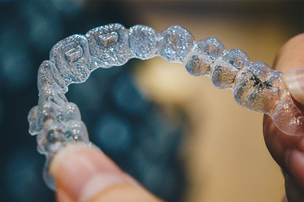 dental-mistakes-aligners