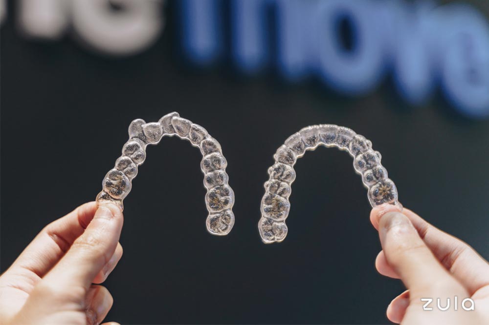 invisalign-singapore-experiences-aligners