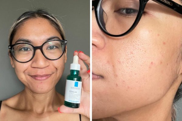 Umulig hele sjæl 5 Girls Tried La Roche-Posay's Effaclar Serum To See If They Could Get  Smooth, Clear & Even Skin After 1 Month - ZULA.sg