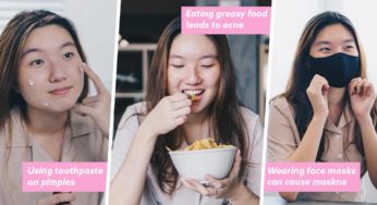 6 Acne Myths Busted By A Dermatologist & How To Properly Care For Them