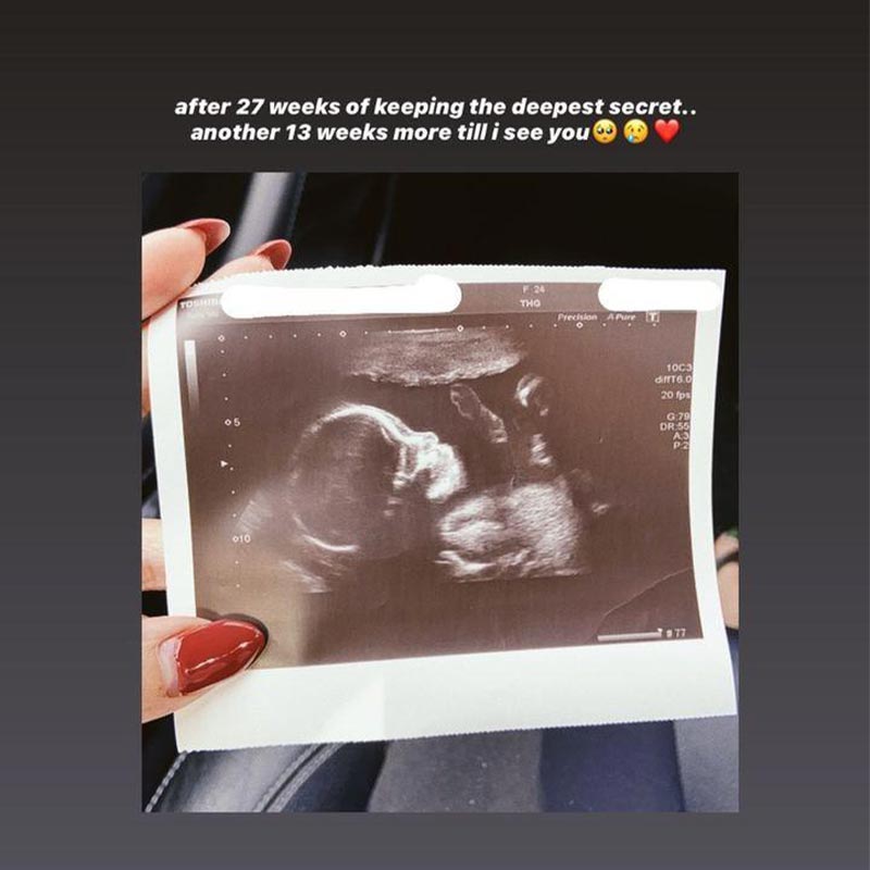 Calling Off Abortion Gwen Lee Reveal Scan