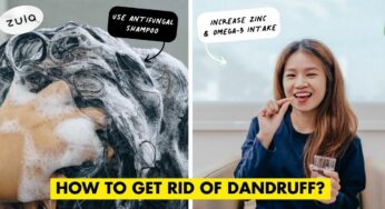 5 Easy Ways To Get Rid Of Dandruff, From Shampoos To Home Remedies