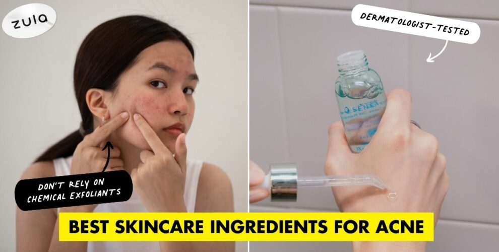 best acne care ingredients skincare