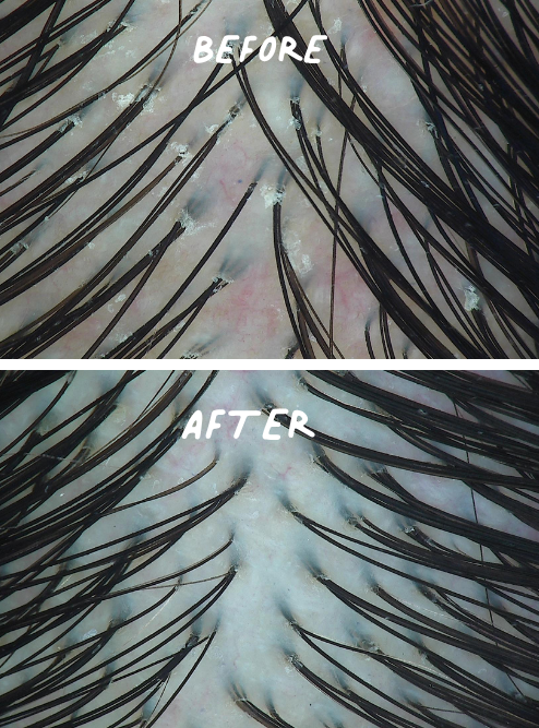 tsubaki scalp shampoo